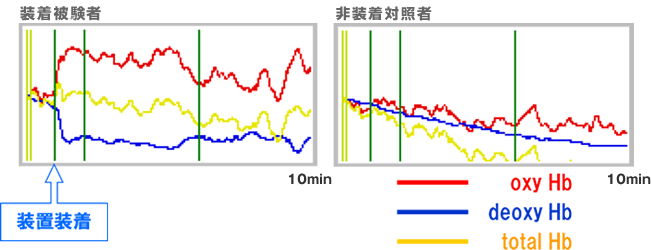 u팱ҁE񑕒uΏƎ